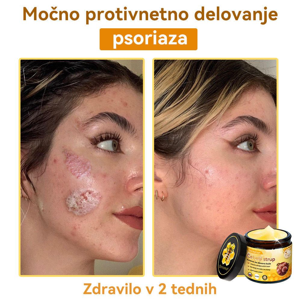 [💯 Brez bolečin-Brez stranskih učinkov] 𝐃𝐨𝐫𝐦𝐨𝐫𝐧𝐚®💥💥Č𝐞𝐛𝐞𝐥𝐣𝐢 𝐬𝐭𝐫𝐮𝐩 𝐊𝐫𝐞𝐦𝐚 𝐳𝐚 𝐨𝐛𝐧𝐨𝐯𝐨 𝐤𝐨ž𝐞- ZADNJI DAN 70% CENEJE