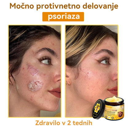 [💯 Brez bolečin-Brez stranskih učinkov] 𝐃𝐨𝐫𝐦𝐨𝐫𝐧𝐚®💥💥Č𝐞𝐛𝐞𝐥𝐣𝐢 𝐬𝐭𝐫𝐮𝐩 𝐊𝐫𝐞𝐦𝐚 𝐳𝐚 𝐨𝐛𝐧𝐨𝐯𝐨 𝐤𝐨ž𝐞- ZADNJI DAN 70% CENEJE