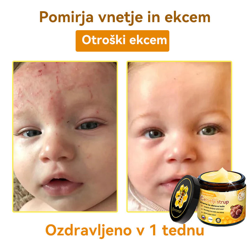 [💯 Brez bolečin-Brez stranskih učinkov] 𝐃𝐨𝐫𝐦𝐨𝐫𝐧𝐚®💥💥Č𝐞𝐛𝐞𝐥𝐣𝐢 𝐬𝐭𝐫𝐮𝐩 𝐊𝐫𝐞𝐦𝐚 𝐳𝐚 𝐨𝐛𝐧𝐨𝐯𝐨 𝐤𝐨ž𝐞- ZADNJI DAN 70% CENEJE