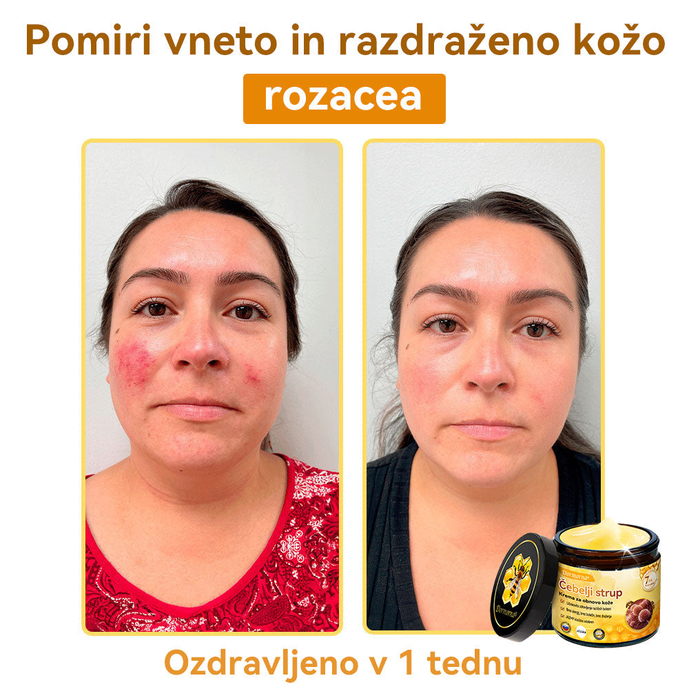 [💯 Brez bolečin-Brez stranskih učinkov] 𝐃𝐨𝐫𝐦𝐨𝐫𝐧𝐚®💥💥Č𝐞𝐛𝐞𝐥𝐣𝐢 𝐬𝐭𝐫𝐮𝐩 𝐊𝐫𝐞𝐦𝐚 𝐳𝐚 𝐨𝐛𝐧𝐨𝐯𝐨 𝐤𝐨ž𝐞- ZADNJI DAN 70% CENEJE