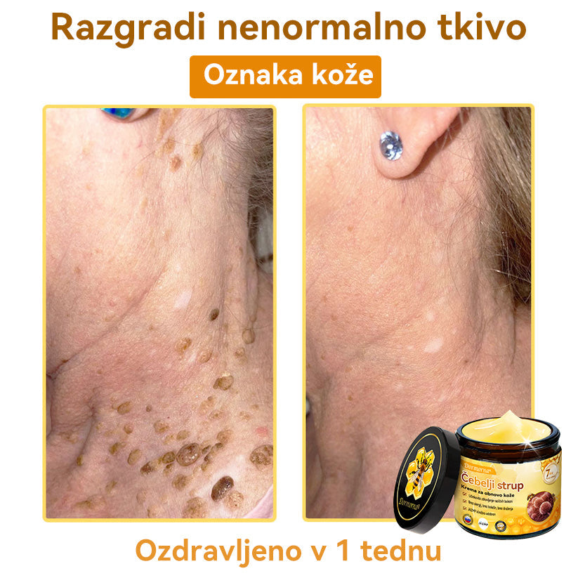 [💯 Brez bolečin-Brez stranskih učinkov] 𝐃𝐨𝐫𝐦𝐨𝐫𝐧𝐚®💥💥Č𝐞𝐛𝐞𝐥𝐣𝐢 𝐬𝐭𝐫𝐮𝐩 𝐊𝐫𝐞𝐦𝐚 𝐳𝐚 𝐨𝐛𝐧𝐨𝐯𝐨 𝐤𝐨ž𝐞- ZADNJI DAN 70% CENEJE