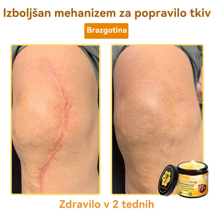 [💯 Brez bolečin-Brez stranskih učinkov] 𝐃𝐨𝐫𝐦𝐨𝐫𝐧𝐚®💥💥Č𝐞𝐛𝐞𝐥𝐣𝐢 𝐬𝐭𝐫𝐮𝐩 𝐊𝐫𝐞𝐦𝐚 𝐳𝐚 𝐨𝐛𝐧𝐨𝐯𝐨 𝐤𝐨ž𝐞- ZADNJI DAN 70% CENEJE