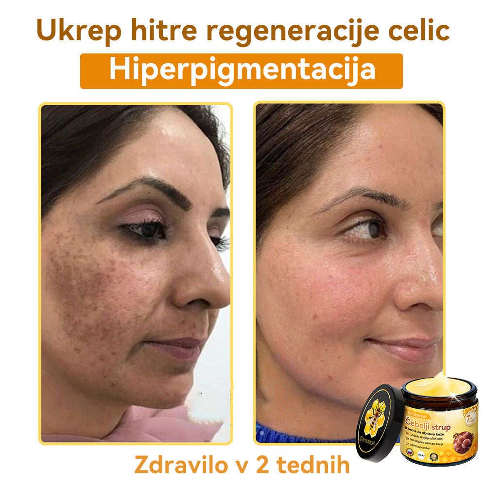[💯 Brez bolečin-Brez stranskih učinkov] 𝐃𝐨𝐫𝐦𝐨𝐫𝐧𝐚®💥💥Č𝐞𝐛𝐞𝐥𝐣𝐢 𝐬𝐭𝐫𝐮𝐩 𝐊𝐫𝐞𝐦𝐚 𝐳𝐚 𝐨𝐛𝐧𝐨𝐯𝐨 𝐤𝐨ž𝐞- ZADNJI DAN 70% CENEJE