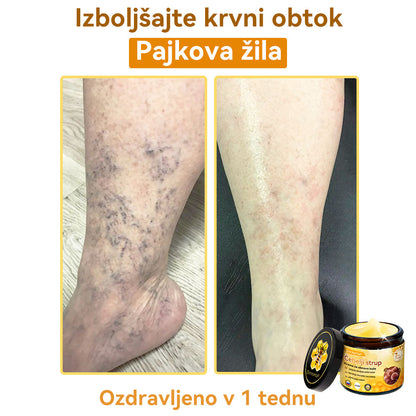 [💯 Brez bolečin-Brez stranskih učinkov] 𝐃𝐨𝐫𝐦𝐨𝐫𝐧𝐚®💥💥Č𝐞𝐛𝐞𝐥𝐣𝐢 𝐬𝐭𝐫𝐮𝐩 𝐊𝐫𝐞𝐦𝐚 𝐳𝐚 𝐨𝐛𝐧𝐨𝐯𝐨 𝐤𝐨ž𝐞- ZADNJI DAN 70% CENEJE