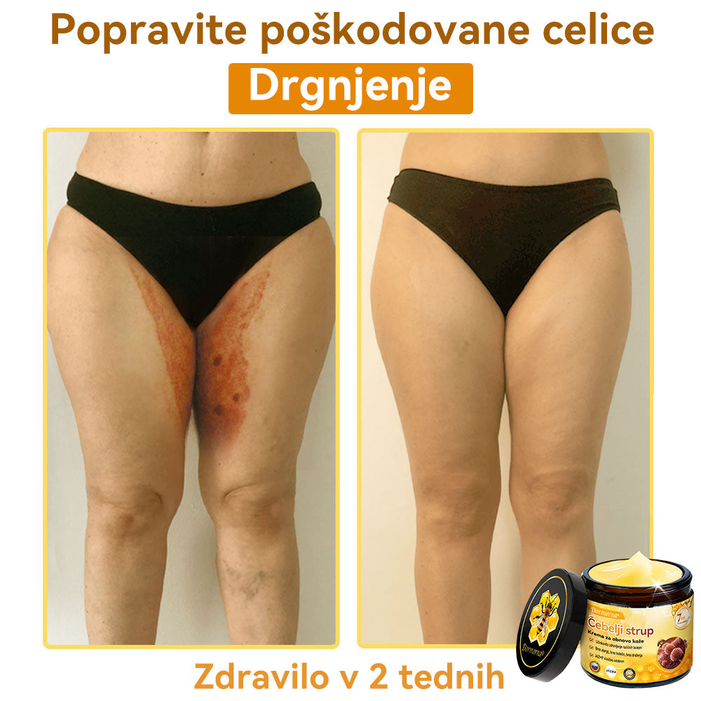 [💯 Brez bolečin-Brez stranskih učinkov] 𝐃𝐨𝐫𝐦𝐨𝐫𝐧𝐚®💥💥Č𝐞𝐛𝐞𝐥𝐣𝐢 𝐬𝐭𝐫𝐮𝐩 𝐊𝐫𝐞𝐦𝐚 𝐳𝐚 𝐨𝐛𝐧𝐨𝐯𝐨 𝐤𝐨ž𝐞- ZADNJI DAN 70% CENEJE