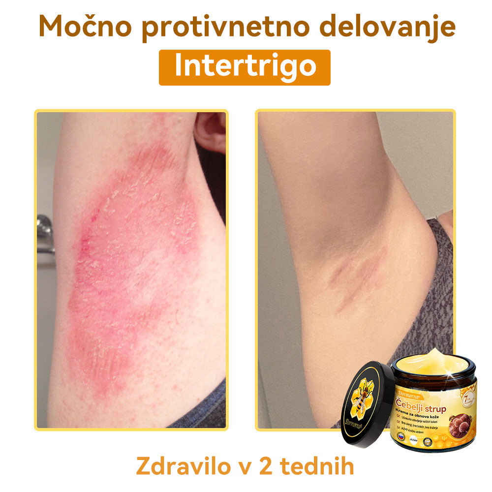 [💯 Brez bolečin-Brez stranskih učinkov] 𝐃𝐨𝐫𝐦𝐨𝐫𝐧𝐚®💥💥Č𝐞𝐛𝐞𝐥𝐣𝐢 𝐬𝐭𝐫𝐮𝐩 𝐊𝐫𝐞𝐦𝐚 𝐳𝐚 𝐨𝐛𝐧𝐨𝐯𝐨 𝐤𝐨ž𝐞- ZADNJI DAN 70% CENEJE