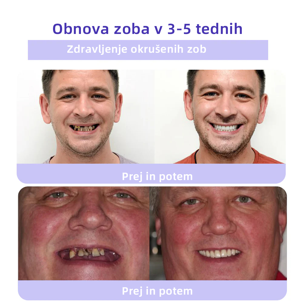 𝐎𝐲𝐢𝐤𝐞𝐲™ 𝐎𝐛𝐧𝐨𝐯𝐚 𝐙𝐨𝐛𝐚 𝐌𝐢𝐧𝐞𝐫𝐚𝐥𝐧𝐢 𝐏𝐫𝐚𝐡а 💋(Primerno za vse bolezni zob, dlesni in težave z ustno votlino)