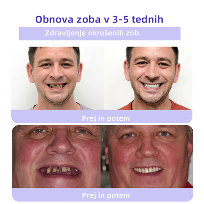 𝐎𝐲𝐢𝐤𝐞𝐲™ 𝐎𝐛𝐧𝐨𝐯𝐚 𝐙𝐨𝐛𝐚 𝐌𝐢𝐧𝐞𝐫𝐚𝐥𝐧𝐢 𝐏𝐫𝐚𝐡а 💋(Primerno za vse bolezni zob, dlesni in težave z ustno votlino)