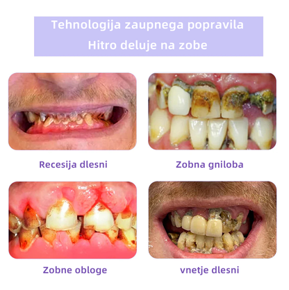 𝐎𝐲𝐢𝐤𝐞𝐲™ 𝐎𝐛𝐧𝐨𝐯𝐚 𝐙𝐨𝐛𝐚 𝐌𝐢𝐧𝐞𝐫𝐚𝐥𝐧𝐢 𝐏𝐫𝐚𝐡а 💋(Primerno za vse bolezni zob, dlesni in težave z ustno votlino)