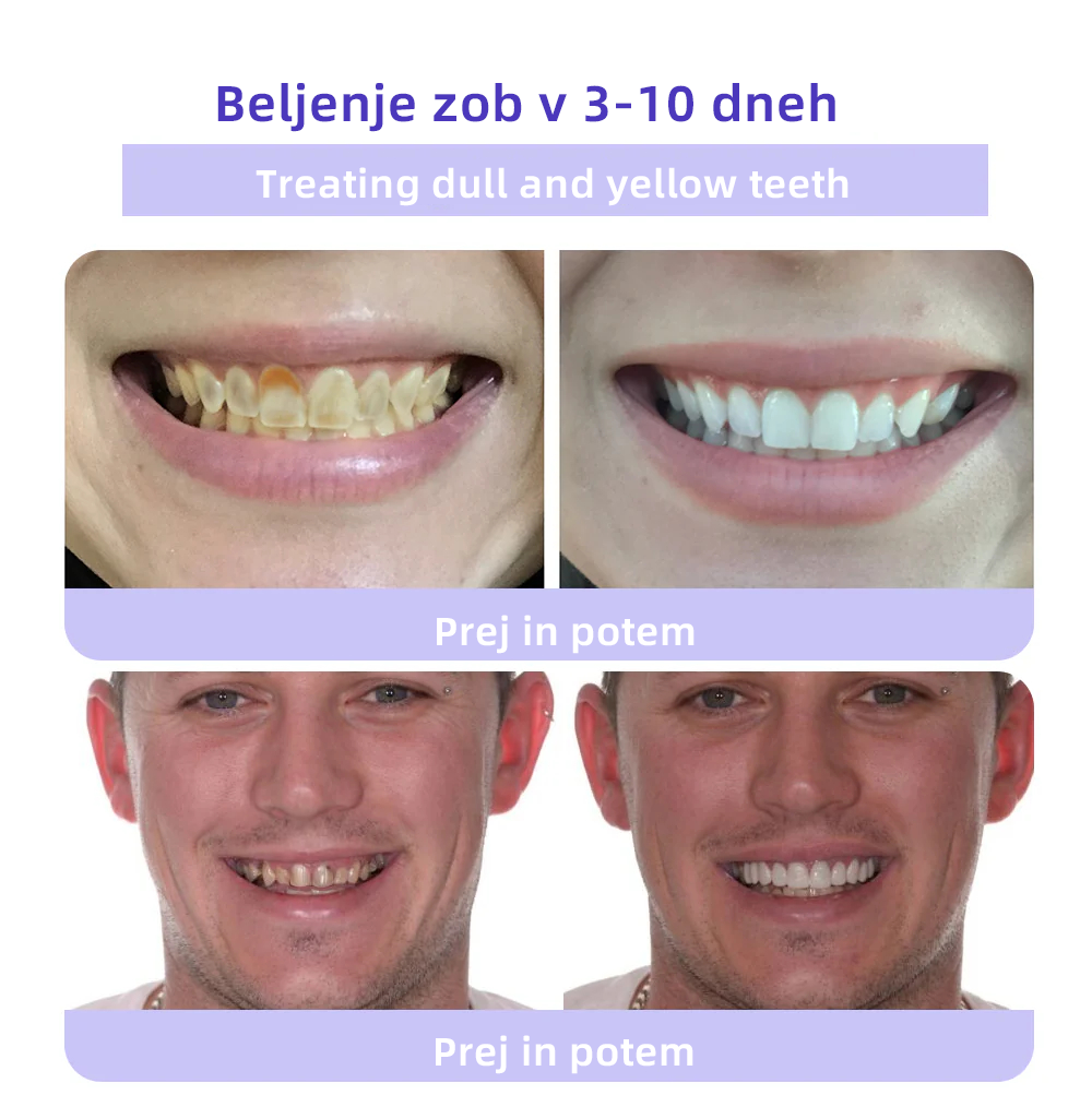 𝐎𝐲𝐢𝐤𝐞𝐲™ 𝐎𝐛𝐧𝐨𝐯𝐚 𝐙𝐨𝐛𝐚 𝐌𝐢𝐧𝐞𝐫𝐚𝐥𝐧𝐢 𝐏𝐫𝐚𝐡а 💋(Primerno za vse bolezni zob, dlesni in težave z ustno votlino)