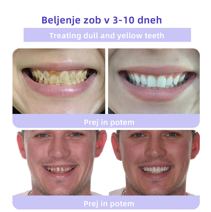 𝐎𝐲𝐢𝐤𝐞𝐲™ 𝐎𝐛𝐧𝐨𝐯𝐚 𝐙𝐨𝐛𝐚 𝐌𝐢𝐧𝐞𝐫𝐚𝐥𝐧𝐢 𝐏𝐫𝐚𝐡а 💋(Primerno za vse bolezni zob, dlesni in težave z ustno votlino)